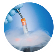 Surgical Sperm Retrieval